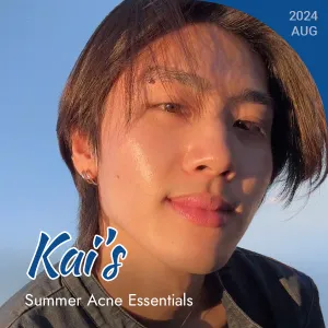 Kai’s Summer Acne Essentials
